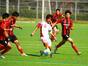 試合シーン100
